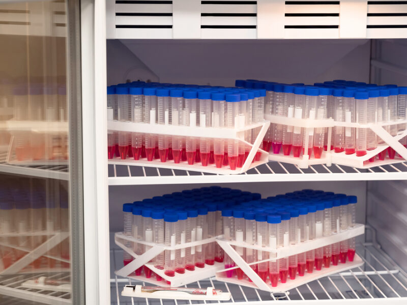 Transparent,Flasks,With,Chemicals,In,The,Refrigerator,In,The,Laboratory.